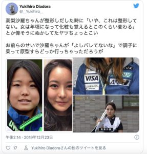 高梨沙羅の整形は医師の暴露で確定 整形した理由はネガティブな性格にあった もっと心に余裕がないとね