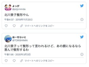 整形してる芸能人６６選一覧 １人１人のビフォーアフター画像を一挙公開 ２０２１年最新版 もっと心に余裕がないとね