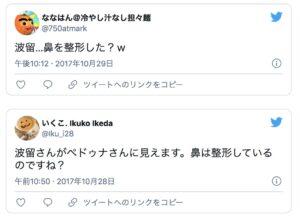 整形してる芸能人６６選一覧 １人１人のビフォーアフター画像を一挙公開 ２０２１年最新版 もっと心に余裕がないとね